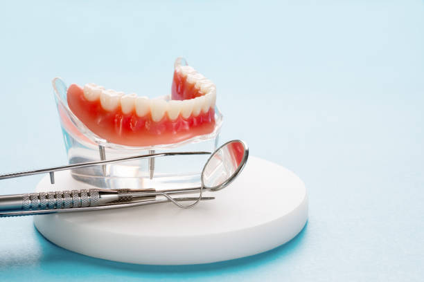 Full Mouth Reconstruction in Forks, WA